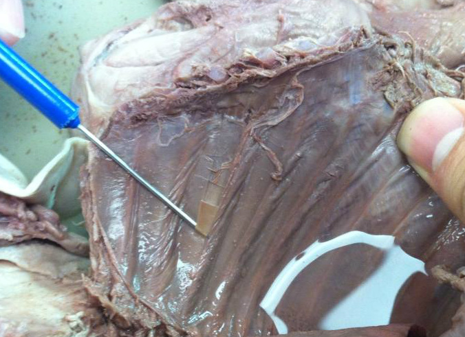 Lungs, bronchi, bronchioles, pleura - How to dissect a fetal pig