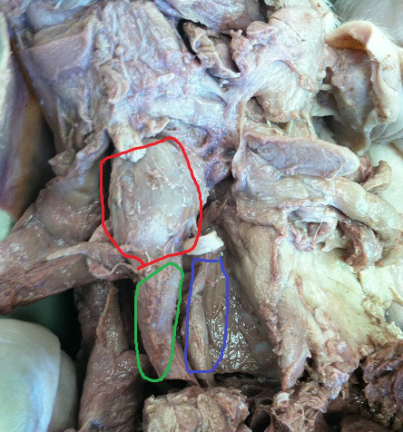 Trachea, Larynx, Carotid arteries, Thyroid gland - How to dissect a