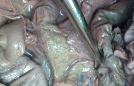 Pancreas - How to dissect a fetal pig