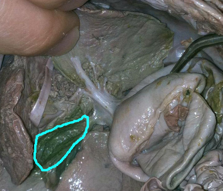 Liver, Gallbladder - How to dissect a fetal pig